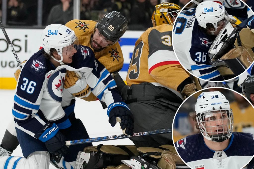 nypostsports's tweet photo. Jets’ Morgan Barron gets 75 stitches after face slashed by skate – and still returns to game https://t.co/nBtzXyrQ3E https://t.co/ytoHVBy6XC