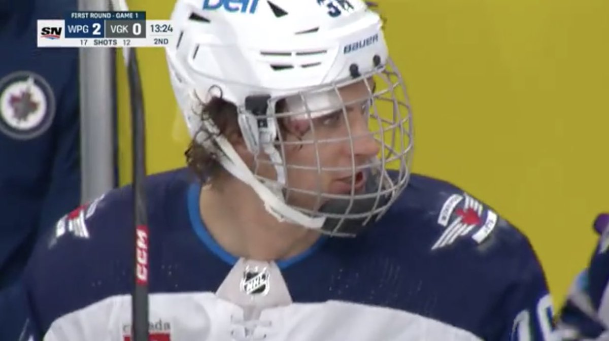 A.J. on Twitter "RT BR_OpenIce Barron required 𝟳𝟱 𝗦𝗧𝗜𝗧𝗖𝗛𝗘𝗦