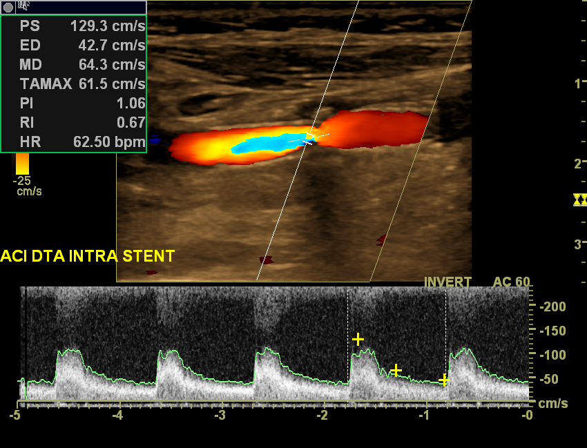 Neurosonology Lab - LHC tweet media