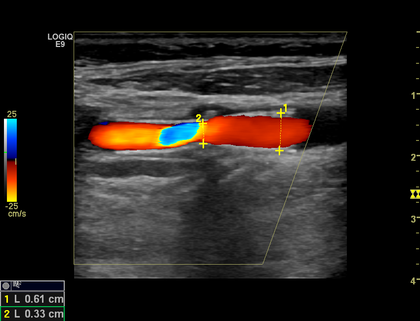 Neurosonology Lab - LHC tweet media