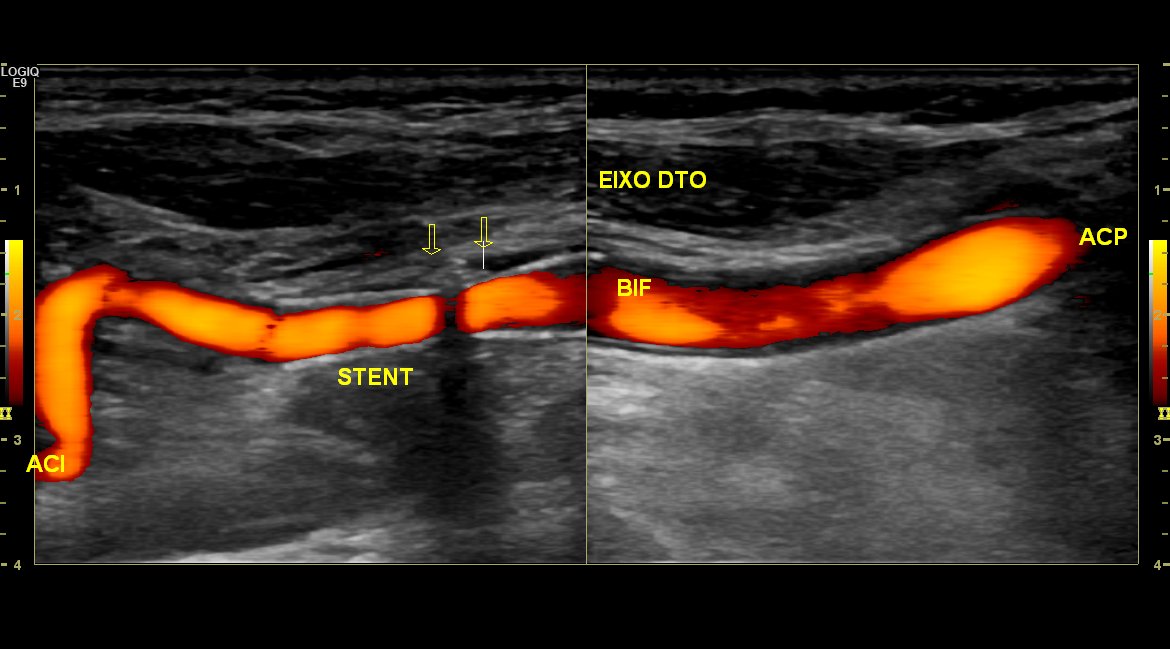 Neurosonology Lab - LHC tweet media