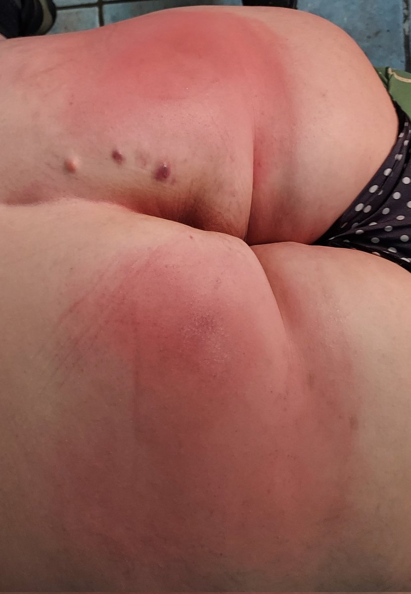 VaderSpankh3r's tweet photo. Just finished giving this naughty girl her long spanking session....I'm sure she will b a good girl now 🤞🤞
#WellDeservedSpanking
#SheNeededIt https://t.co/ajih0rs5nX