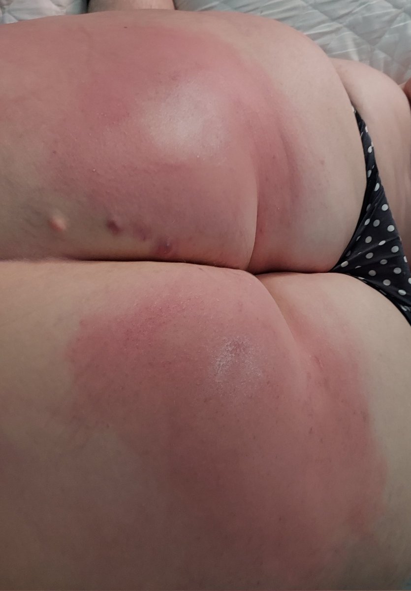 VaderSpankh3r's tweet photo. Just finished giving this naughty girl her long spanking session....I'm sure she will b a good girl now 🤞🤞
#WellDeservedSpanking
#SheNeededIt https://t.co/ajih0rs5nX