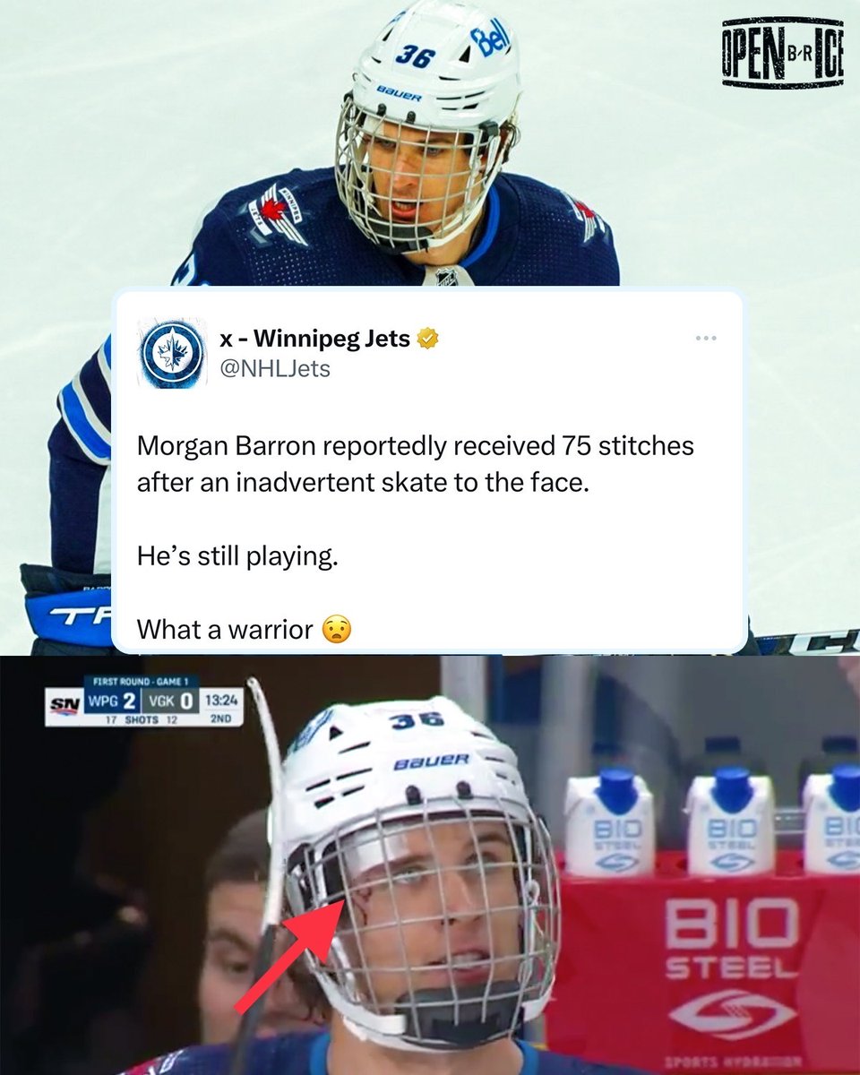 Ricardo on Twitter "RT BleacherReport He got 75 stitches after being