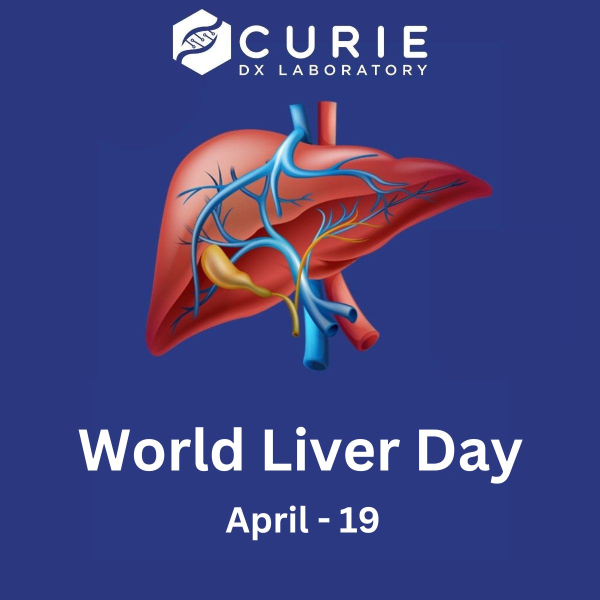 CurieDxLab's tweet photo. The liver is a vital organ of our body that removes toxins..!! This World Liver Day, let's pledge to keep it safe.! Remember, "A Healthy Liver, a Happy Life." 

#WorldLiverDay #April19 #Vital #Organ #Health #Medical #Laboratory #CurieDXLab #Richardson #Dallas https://t.co/D4juzutdAl