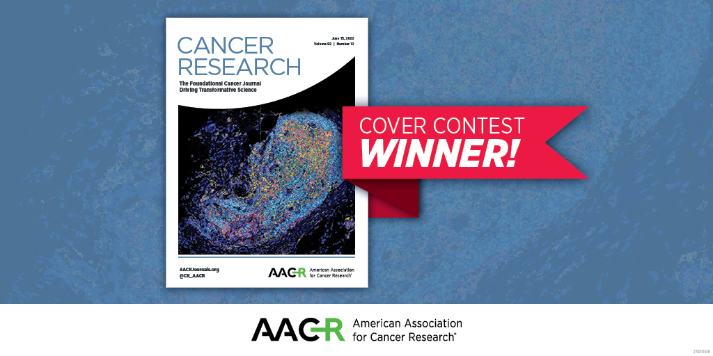Cancer Research (@cr_aacr) on Twitter photo The June 15, 2022 issue received the most votes in our cover contest! Congrats to the authors from—
#Chemotherapy/macrophage inhibition leads to TNBC regression.
bit.ly/3KP5YjM
<a href="/JeffMRosen/">Jeffrey Rosen</a> #TripleNegativeBreastCancer #AACR23 The June 15, 2022 issue received the most votes in our cover contest! Congrats to the authors from—
#Chemotherapy/macrophage inhibition leads to TNBC regression.
bit.ly/3KP5YjM
<a href="/JeffMRosen/">Jeffrey Rosen</a> #TripleNegativeBreastCancer #AACR23