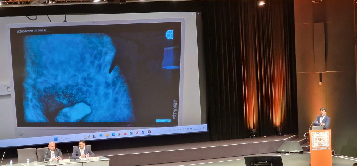 SFUPA1's tweet photo. Our newly promoted Professor Arnaud @CHURennes @RennesUniv shows us how challenging cripple #hypospadias can be. Using a flap can be one option though #bettercare #complexcases #innovation @ESPUorg #ESPU23 https://t.co/tgH9AM5xWR