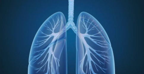 MedPipeline's tweet photo. Will Tabrecta cure lung cancer? #Tabrecta (capmatinib) is an oral tablet approved to treat adult patients with metastatic non-small cell lung cancer (#mNSCLC) with specific mutations (MET exon 14 skipping), as detected by an FDA-approved test. https://t.co/d8B1e0itDE https://t.co/UWf9NnFo3o