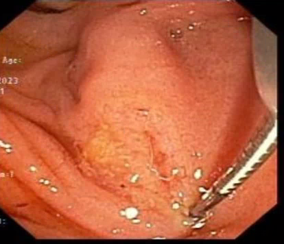 Manol Jovani, MD MPH tweet media