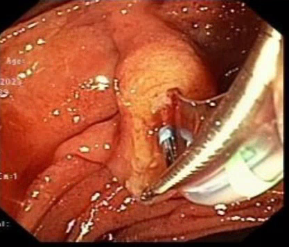 Manol Jovani, MD MPH tweet media