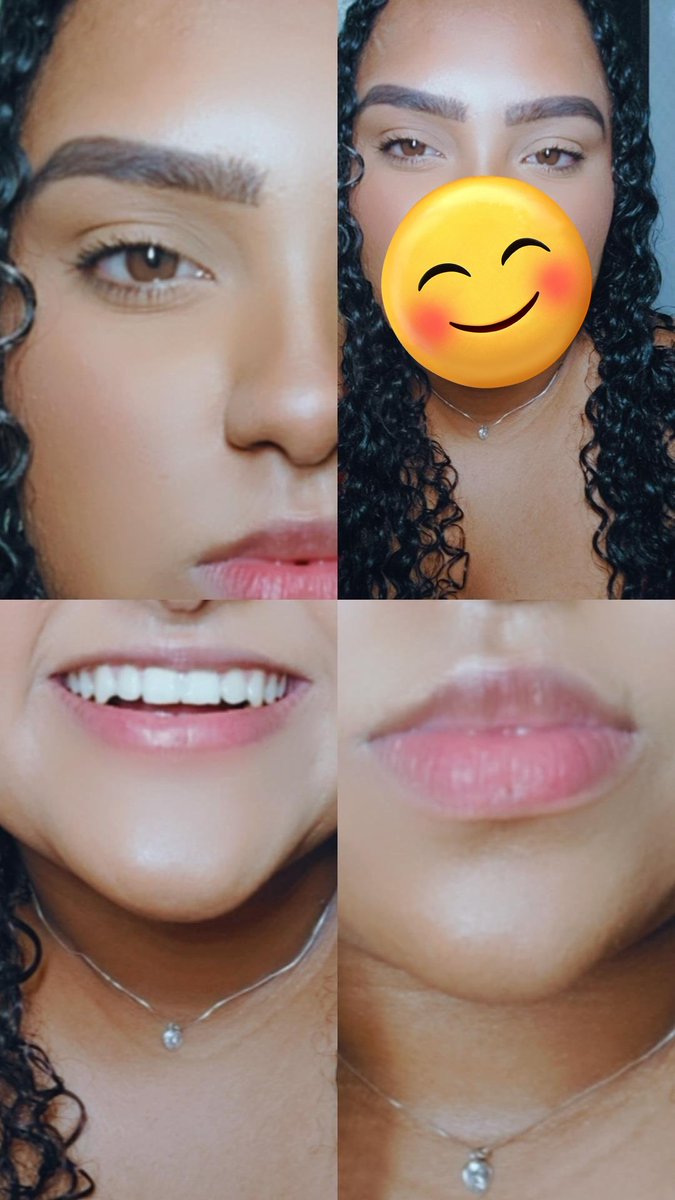 Detalhes...🔥