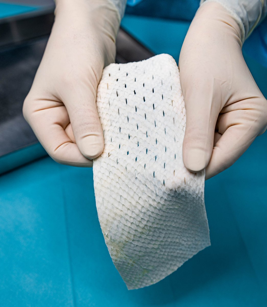 kerecis's tweet image. Big news! 👏 Over 150 million Americans or around 45% of the US population can now benefit from #Kerecis! 🙌 This year, 63 million more Americans became eligible for insurance coverage for our #FishSkin treatments, marking a 70% increase. Learn more here: bit.ly/41kEBoN