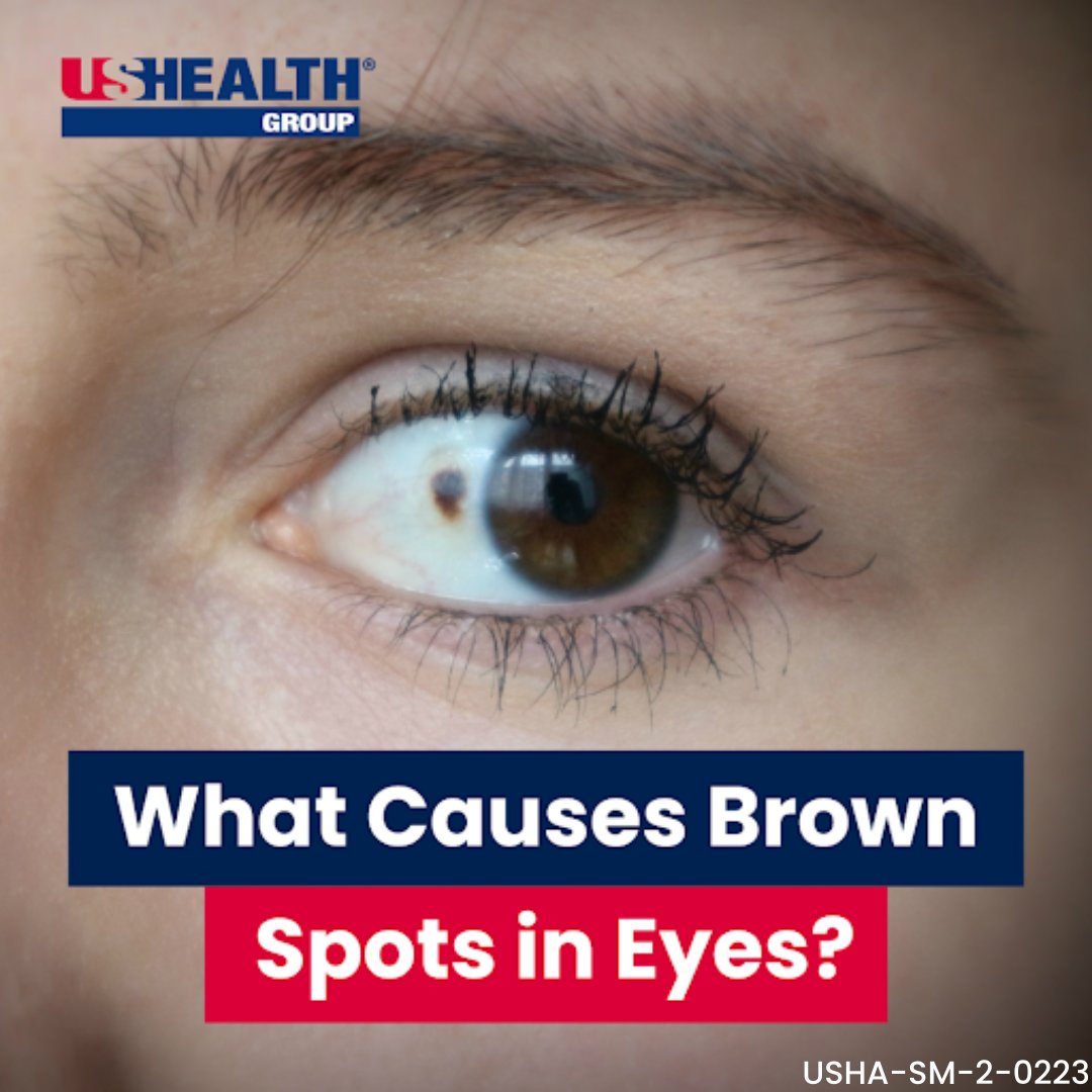 SEE for yourself in our blog post 👀 >> bit.ly/3IfUHJ5