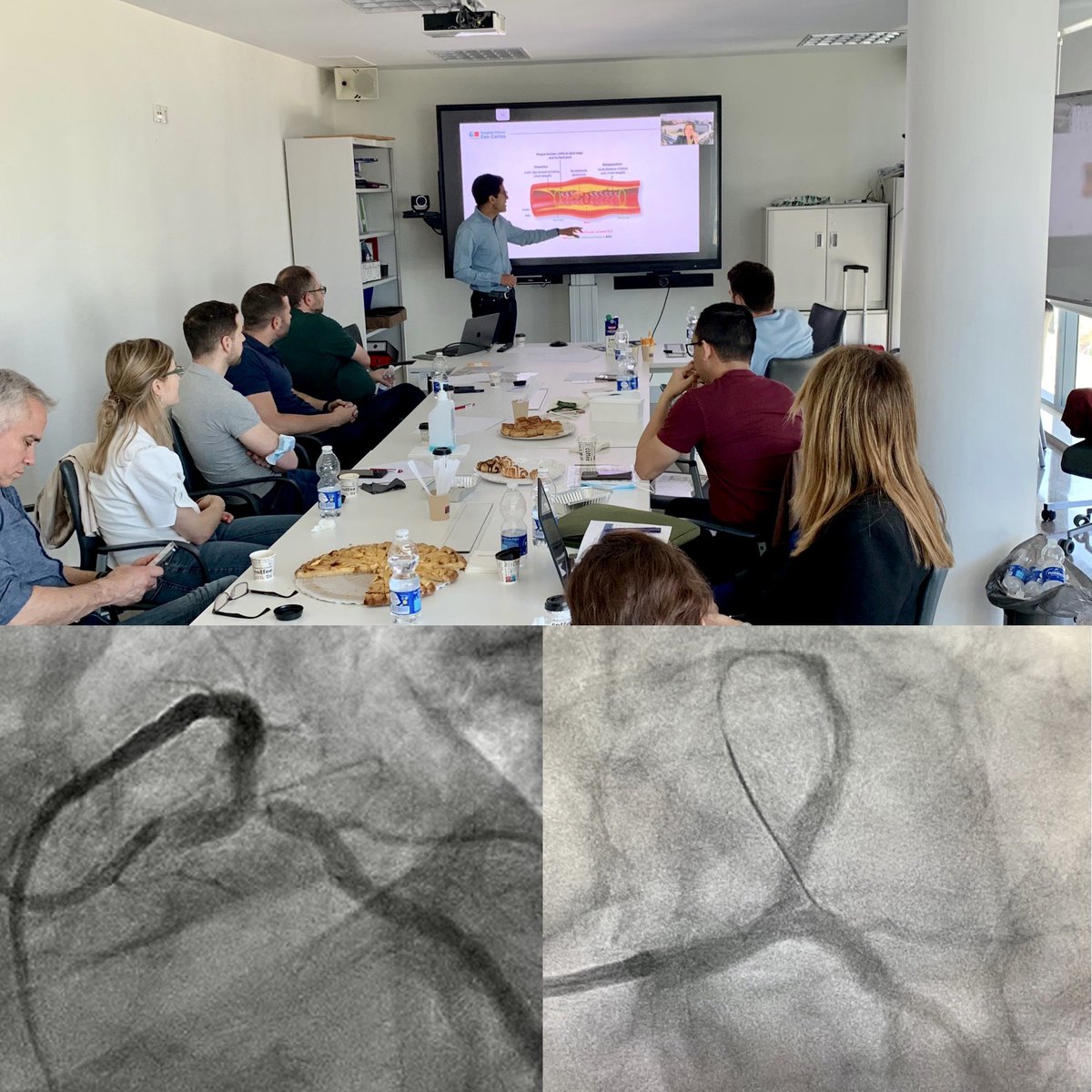 Hands-on workshop on bifurcation PCI! A lot of interaction and learning thanks to @pabl0salinas @beavaquerizo @Jp_vilchez @JL_10_HILL @MedtronicES