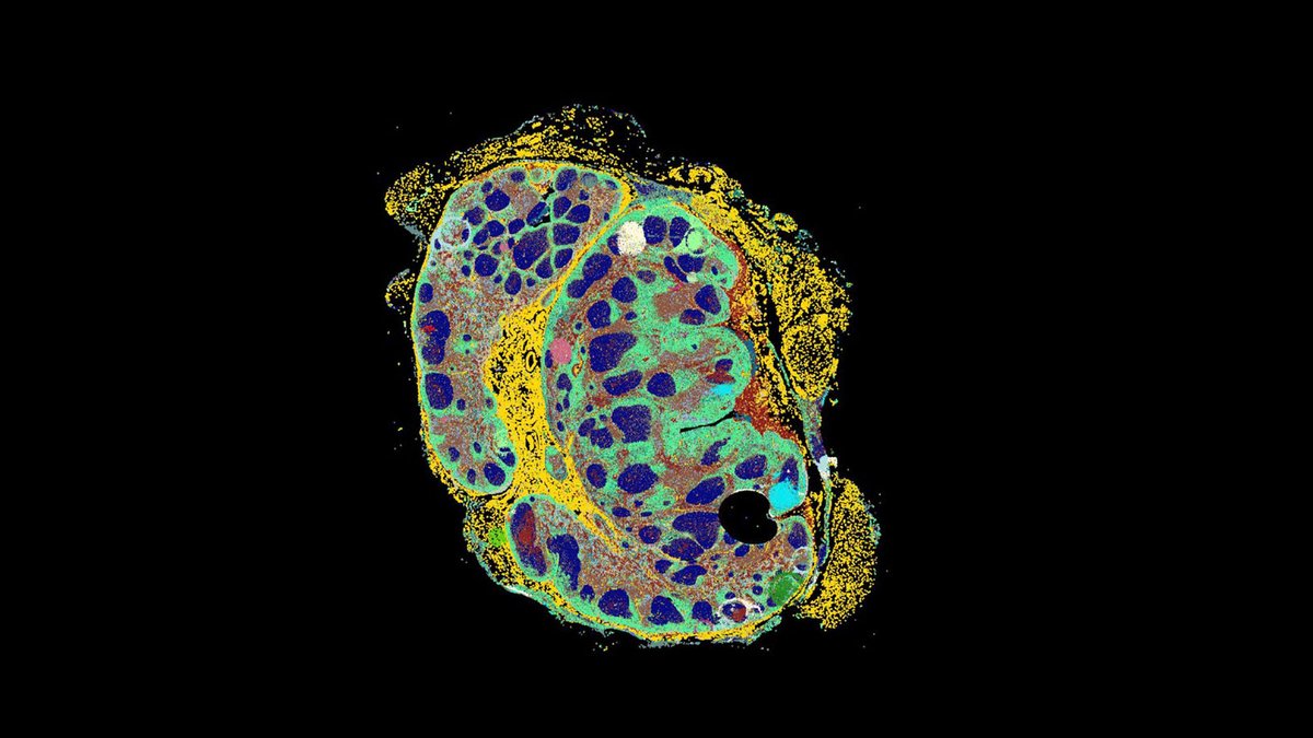 _hubmap's tweet photo. Does this lymph node look suspiciously crab-like to you? This is actually a CODEX image of a #lymphnode, made by HuBMAP researcher @archie_enninful with an @AkoyaBio Phenocycler system. The different colors represent 26 cell types within! Crab-solutely amazing! #CellMapCrew https://t.co/E1pW6t0jzt