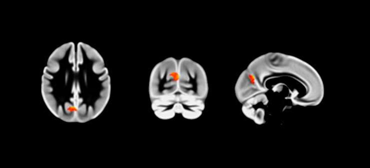 Not everyone needs to be a morning person to succeed☀️

And science says that is okay👩‍🔬

In fact, “night owls” have:
🧠Higher IQ 
💰Higher avg. income 

"Night owls" brain is wired differently

🧵 Thread you don't want to miss if you are a "night owl" or know someone who is 👇