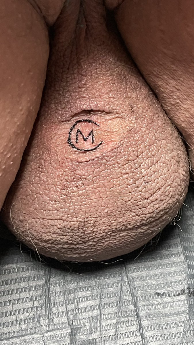 I had my pup marked with my initials on its last visit. The spot where it is, was from an old piercing that rejected. <a href="/SIRshappymutt/">SIRshappymutt</a> @tattoosbyhermit