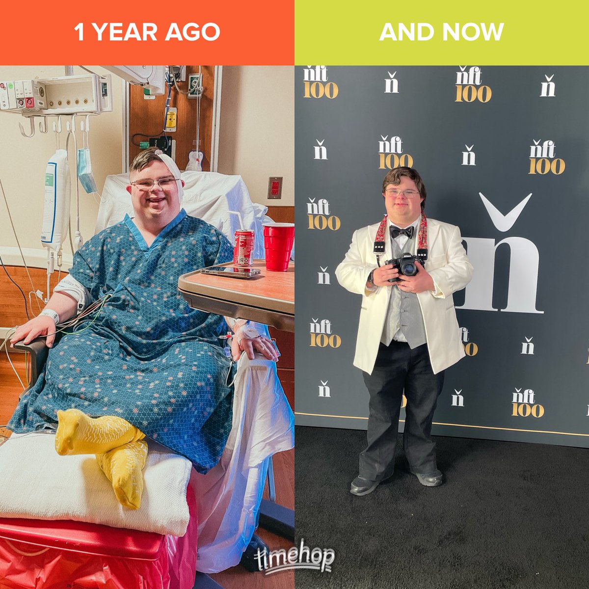 DownsandTowns's tweet photo. One year ago today I was at Vanderbilt hospital recovering from an 8-hour brain surgery. 

Super grateful for every single day!

⁦@nftnow⁩ https://t.co/jQlUYF4nJR