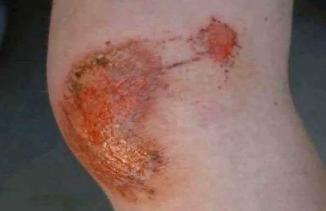 Whotfismick's tweet image. This generation of kids will never know this pain, we were outside 24/7