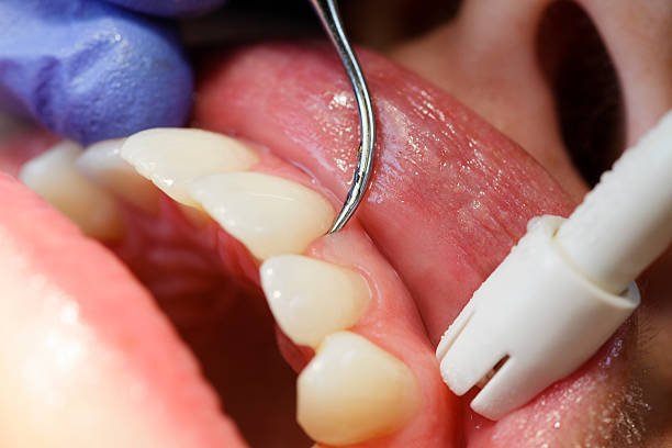 TownCenter4500's tweet photo. Did you know that your gums and teeth are equally important? Take care of them as well to maintain a healthy smile. https://t.co/SxO2SdmTdy