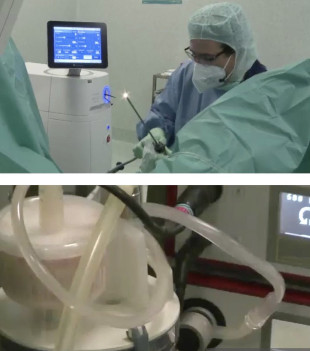 enrique_rijo's tweet photo. GreenLight laser enucleation of the prostate #GreenLEP and Holmium laser enucleation of the prostate #HoLEP with Moses 2.0 Workshop. Visitors from Mexico, Costa Rica, Colombia and Panama #BPH #GreenLight #HoLEP #Moses @bsc_urology @BSCEDUCARE https://t.co/0c3PSKziao