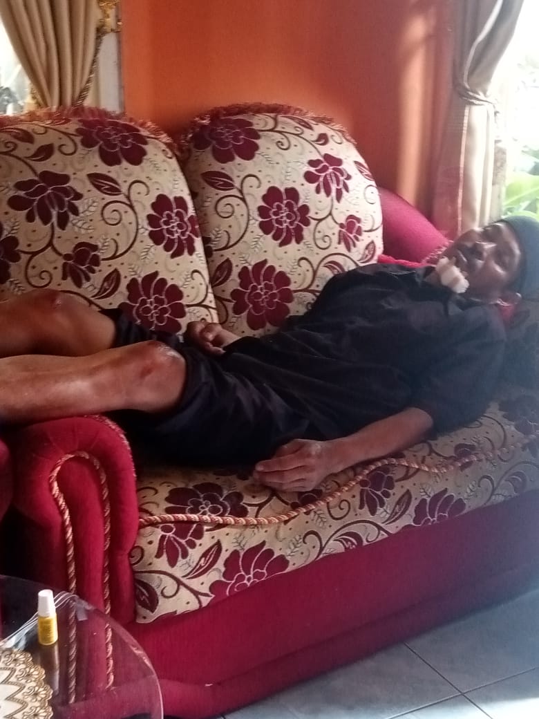 chumnam4's tweet photo. @kegblgnunfaedh Padahal mending dianya minta maaf.
Ini bapakku kemarin siang diserempet, orang yg nyerempet boro2 minta maaf. Apalagi tanggung jawab. Malah ngajak gelut. 
Bapak tulang punggung keluarga. Makanya meski masih sakit, hari ini bapak maksain ke Bandung nganter ikan😢 https://t.co/B7WXxAWwMo