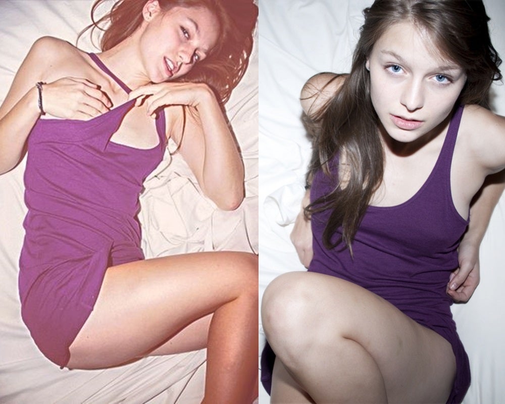 Melissa Benoist ICLOUD