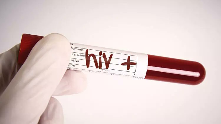 yirmiucderece's tweet photo. İstanbul'da ameliyat olan böbrek hastası Ahmet Emin Bilgin’e, Kızılay’ın verdiği kanda HIV tespit edildi.

Virüslü kan verilen Bilgin yaşamını yitirdi. Kızılay ve hastane toplam 770 bin lira tazminat ödemeye mahkum edildi.

(Hürriyet) https://t.co/hF4Zo8Mwha