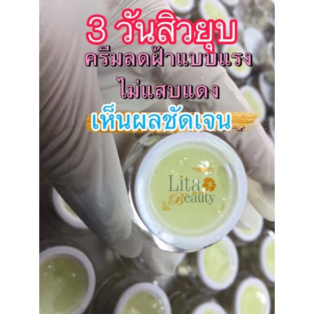 thelitabeauty's tweet photo. ฉันกำลังขาย 3 วัน!!ฝ้าหายขาด|สิวยุ... ที่ Shopee ในราคาสุดพิเศษเพียง ฿156 ซื้อเลยที่ https://t.co/HwxR44lqWR #ShopeeTH https://t.co/CFo7NIfEaj