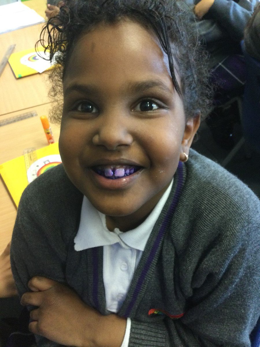stanton_bridge's tweet photo. Today our year 4 students, learned valuable lessons about how to keep their teeth healthy and free of decay. We explored the importance of brushing and flossing regularly, as well as the types of foods that can lead to tooth decay. #Year4DentistryLesson #ToothDecayPrevention🦷 https://t.co/R6Agk4XgAC