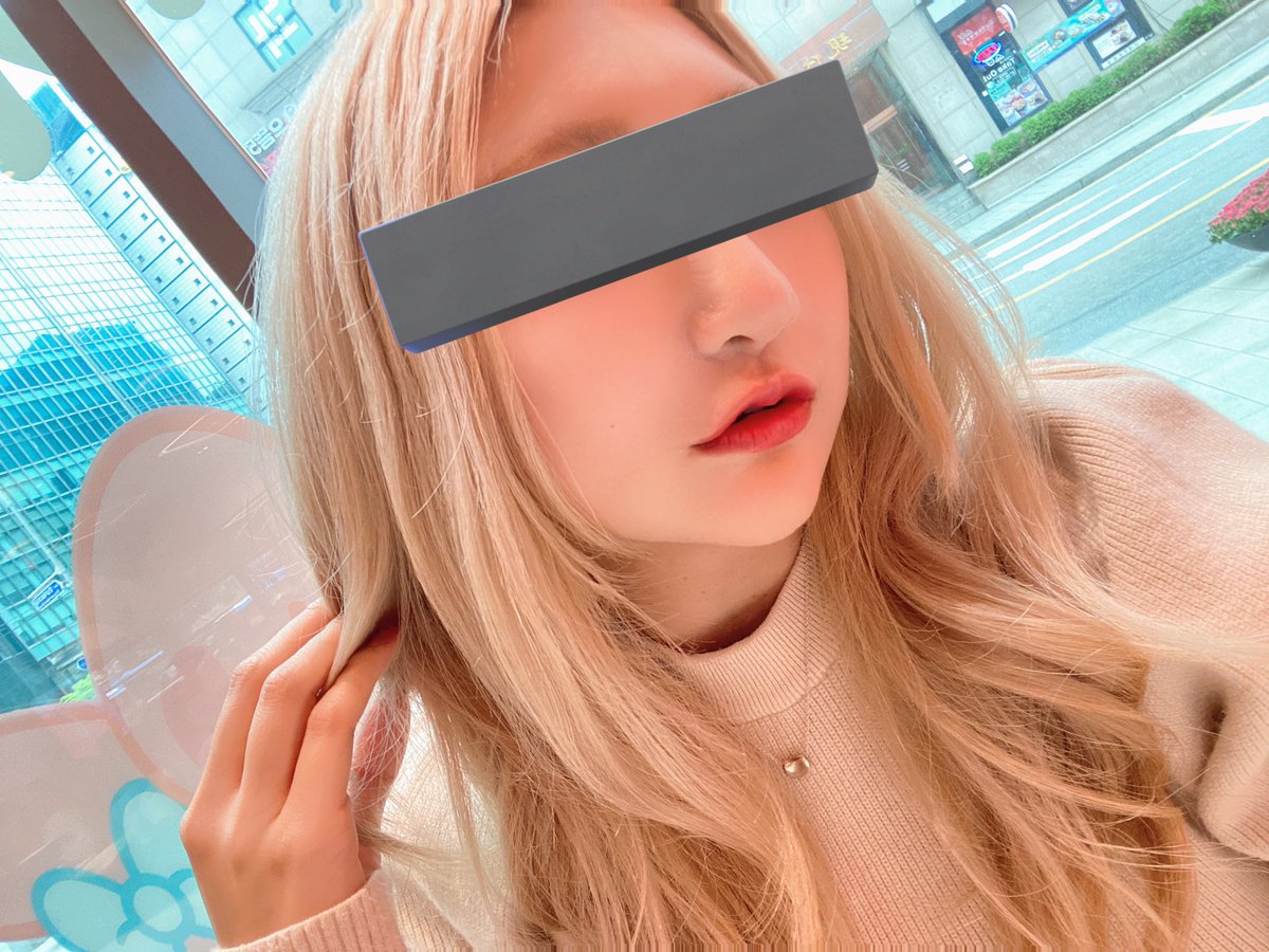 krm_hnk's tweet photo. 5ヶ月目。
人中の術後の硬さと言うか、つっぱり感がもうほとんどなくなって違和感は無い。
口角は維持出来てる🥰 https://t.co/k2sHJsxLCf