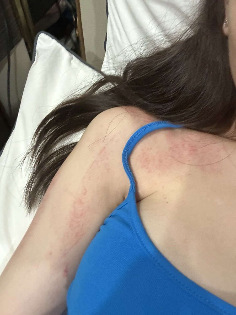 εїз 𝙉𝙊𝙉𝙂𝙊 #ไม่เอาสงคราม tweet media