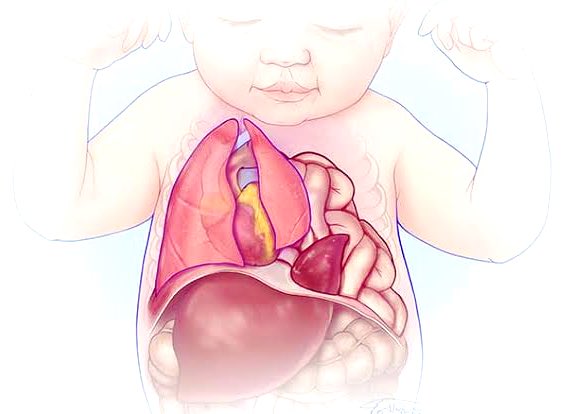 CirugiaPediaMx's tweet photo. Abril, mes de concientización acerca de la HERNIA DIAFRAGMÁTICA CONGÉNITA y 19 de abril, día mundial👶🏻👍🏼 @cdhintl 
Una enfermedad que ocurre hasta en 1 de cada 2500 nacimientos.
#some4pedsurg
👉🏻Te recomendamos los siguientes artículos… 🧵 https://t.co/QjFHSwWC7r