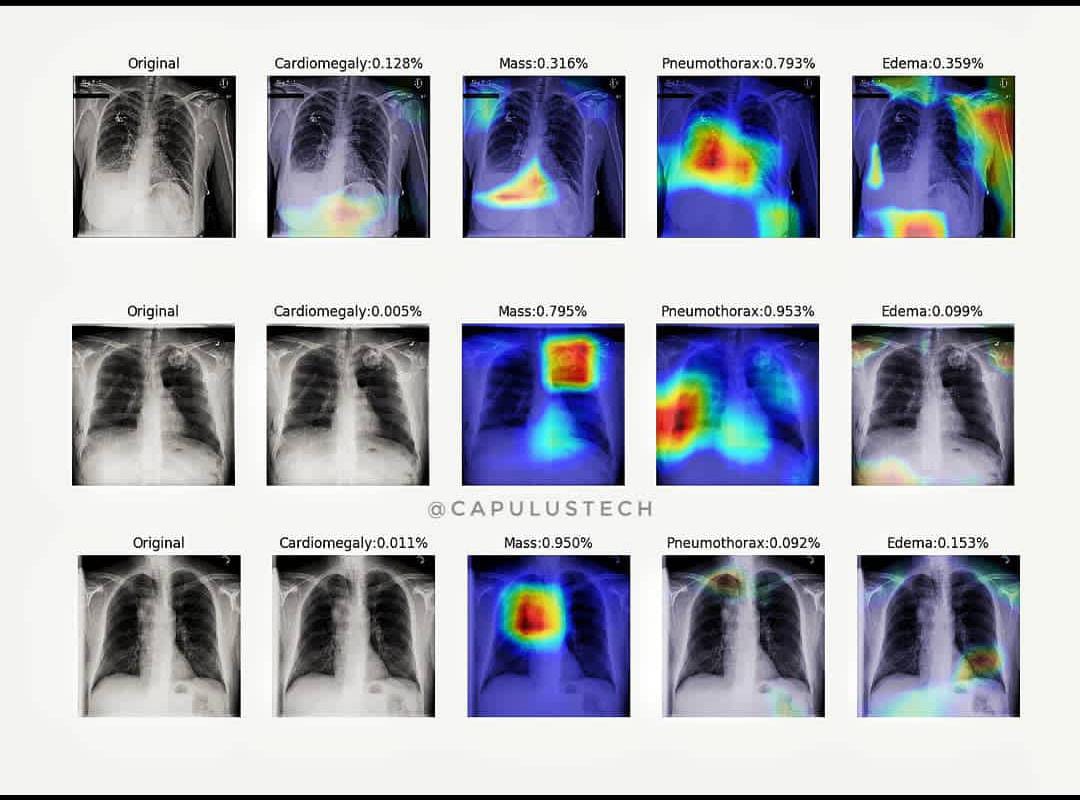 drprajwalbhat's tweet photo. A transfer learnt DenseNet model for X-ray image classification.

The diagnostic performance measured by AUC and ROC visualised using GradCams Model has trained with ChestX-ray8 dataset. 
#capulustech #DigitalTransformation #MEDTECH https://t.co/hjLYVkFyFa