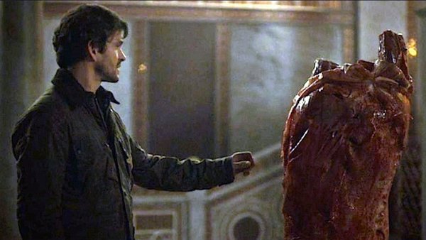 ₊˚⊹♡ Hannigram on crack ♡ ˚.* (@crackhannigram) on Twitter photo 