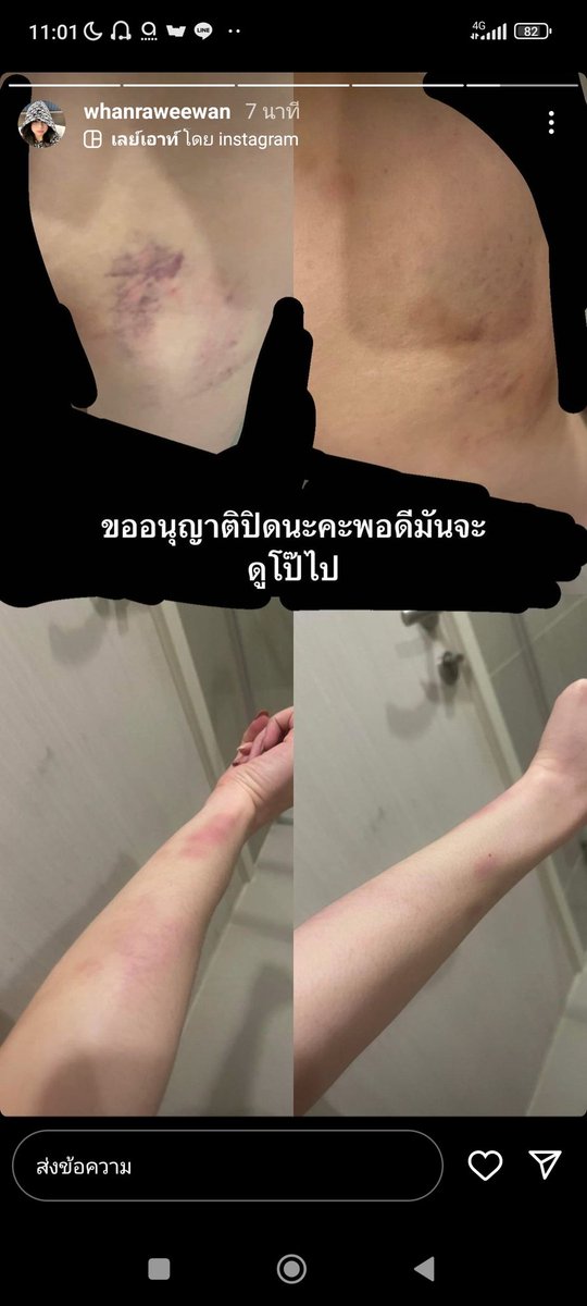 nj_inna's tweet photo. #tndtleทําร้ายผู้หญิง https://t.co/t1qbyOoUmu