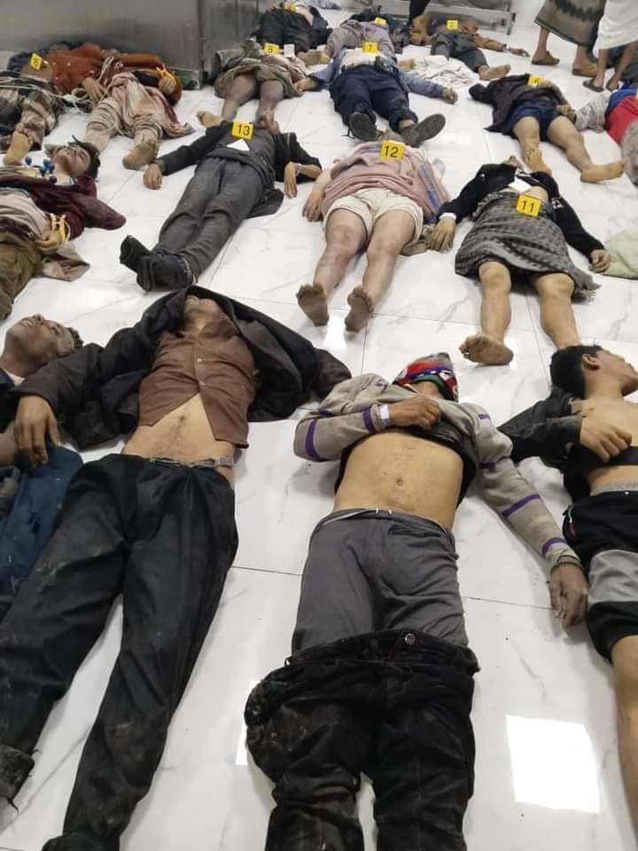 80 شهيدا في صنعاء بحادثة التدافع والماس الكهربائي ضمن 200 أصيبوا أيضا وهم يستلمون مساعدات من الكبوس وسبب التدافع و اطلاق الرصاص من بعض مسلحي الكهنوت مما سبب تدافع الناس وهروبهم  مع فصل الكابل الكهربائي القريب منهم وتسبب التدافع والصعق بوفاة 80 ضحية وأكثر من 200 مصاب اتعضو