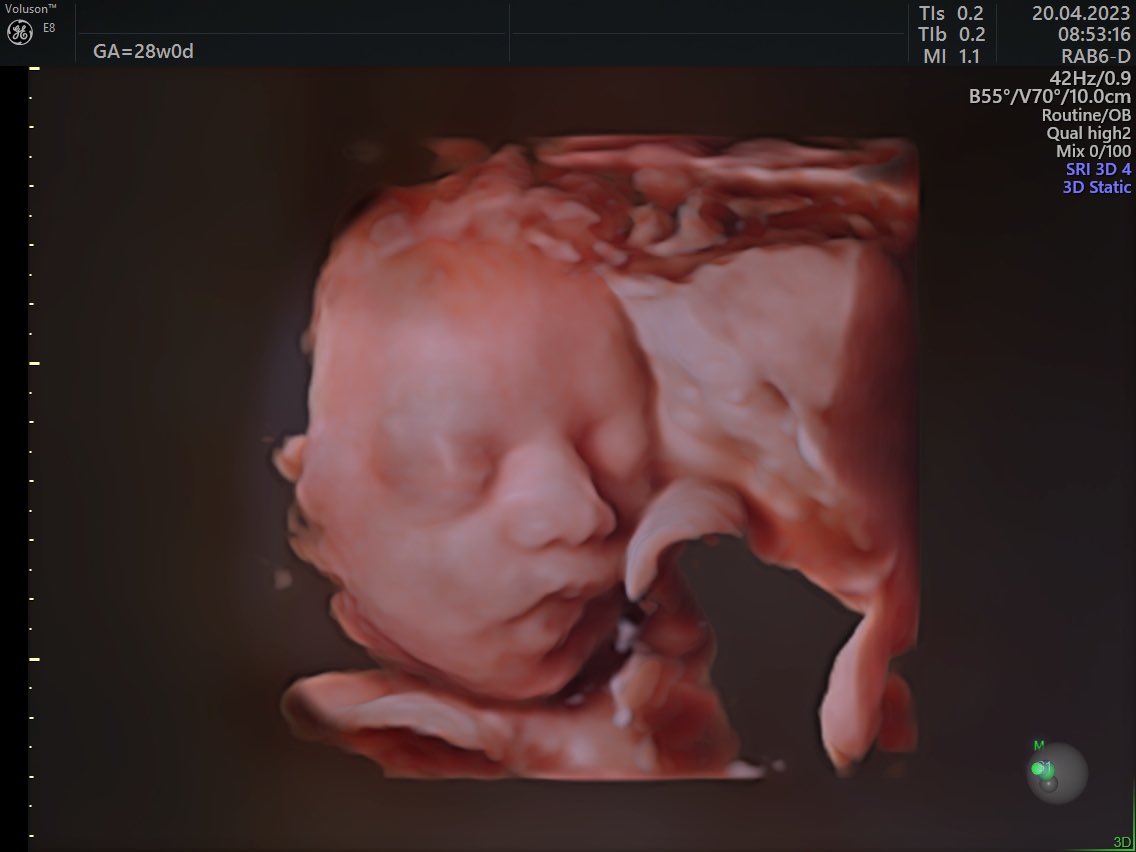 SallyElAzzi's tweet photo. 28 weeks. 💫💙🙏 https://t.co/B1OkYD5yRQ