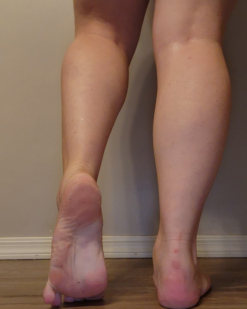 Vet_tech_feet's tweet photo. #feetfethish #feetpic #feet_lover #feetpicsforsales #feet_pic #footpics #thickthighsavelives https://t.co/EzIzf2NCwL