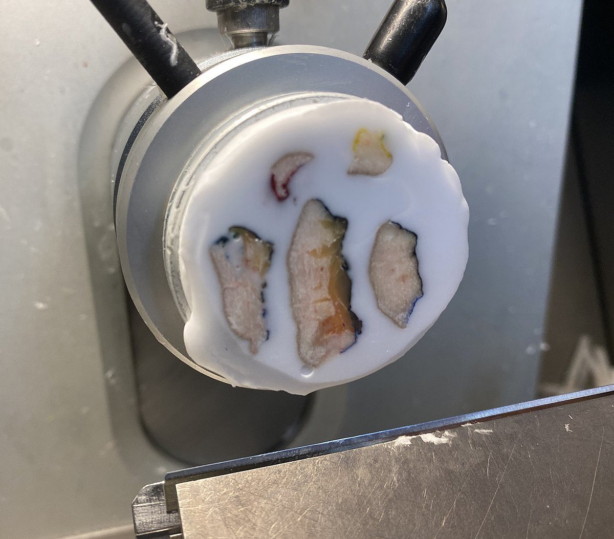 Path4People's tweet photo. When your health needs a quick inspection,
And your tissue's in need of detection,
Pathologists use frozen sections,
A life-saving tool, no need for objections! ❄️🔍 #pathologyrocks #pathologypoetrythursday https://t.co/aBvfY3MutQ