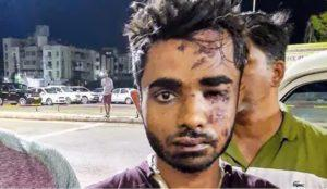 ImtiazMadmood's tweet photo. India: Shahrukh Saifi, charged with putting the train passengers on fire in Kerala’s Kozhikode district is a ‘highly radicalized’ fan of jihad preacher Zakir Naik.

He apparently was endeavoring to “strike terror in the enemies of Allah” (Qur’an 8:60).

Saifi has been constantly watching Naik’s videos.