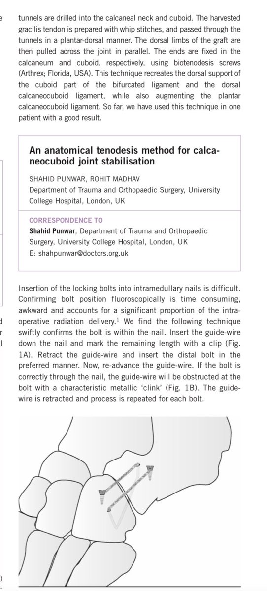 AnkleFootMotion's tweet photo. @Flawless_Physio Also occasionally CCJ can be unstable, and subluxate/dislocate. The text is a bit mixed up for some reason, but was published as a tip for stabilization. Came with hx of unstable ankle but all the time the mid-foot CCJ was dislocating! https://t.co/9vhO871JpX