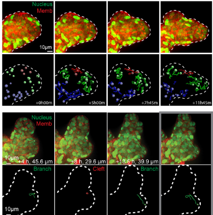 J_Cell_Sci's tweet photo. The final day of #DynamicCellV #BiochemEvent kicks off with a fantastic talk from our Editor Andrew Ewald dissecting the cellular and molecular dynamics of cancer invasion and metastasis.
Check out their work on collective cell migration here:
https://t.co/lmjhGnIAIY https://t.co/VFxDOWT3x9