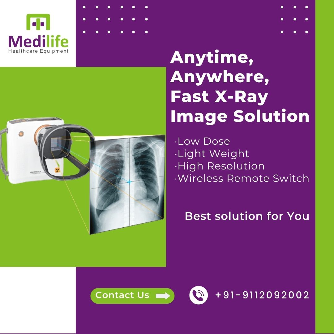 Medilifemktg's tweet image. Anytime, Anywhere, Fast X-Ray Image Solution
Best Solution For You. Please contact us on 9112092002
#portablexraymachine #DigitalHandheldXRayCamera #DigitalXRayMachine #HandheldXRayCamera #PortableXRayDigitalCamera #XRay #radiologist #gynacologist #MedilifeHealthcareEquipment