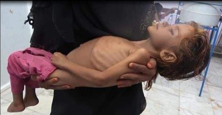 AliAlAhmed_en's tweet photo. @PowerUSAID Said the woman who is directly involved in the starvation of #Yemen &amp; the killing of 1/2 million children.  #UNSC2216 https://t.co/MCvZbNsYED