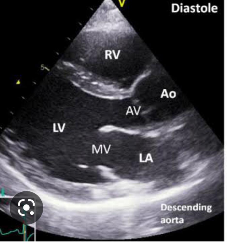 CRADdiagnostics's tweet photo. Echocardiography is an ultrasound of the heart. It is used to assess heart muscle disease, blood flow through the heart, heart valve abnormalities etc.
Hypertension is a common disease in our environment which can affect the heart.
If you have a heart condition, ask for ECG. https://t.co/j6vDdnADGP