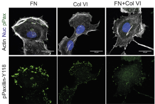 J_Cell_Sci's tweet photo. @LMachesky brings the #DynamicCellV #BiochemEvent meeting to a close with a fantastic talk on mechanosensing in the pancreatic cancer microenvironment.
You can check out some of their research here: https://t.co/hvS9JtmjnL https://t.co/zyjSwp6HMw