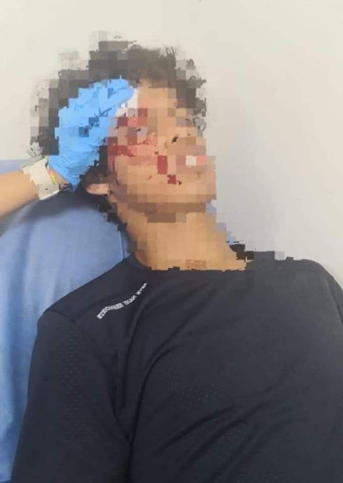 ColombiaOscura's tweet photo. #BARRANQUILLA. Ventilador le cayó en la cabeza a un estudiante de la Uniatlántico. El accidente sucedió en la Sede Norte. El estudiante resultó con heridas en su rostro y cráneo por lo que fue llevado a un hospital. https://t.co/tDiFQKvGt7