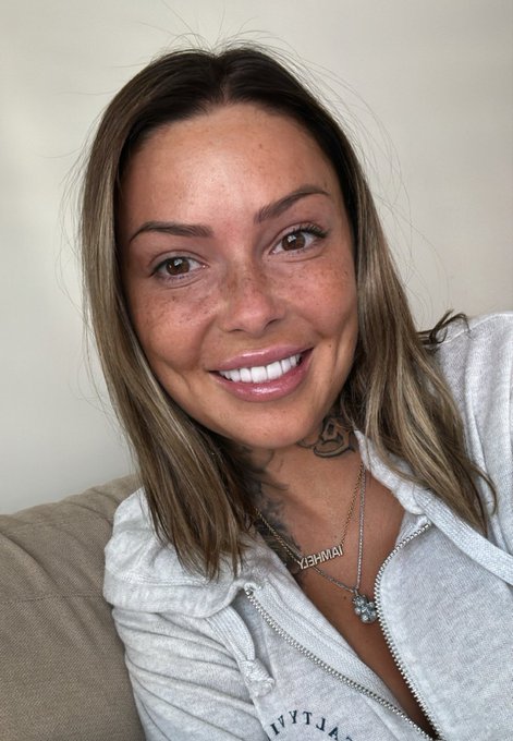 Do you love me more natural ? Retweet if you loce freakles 🌟 https://t.co/CQywnVpeZP