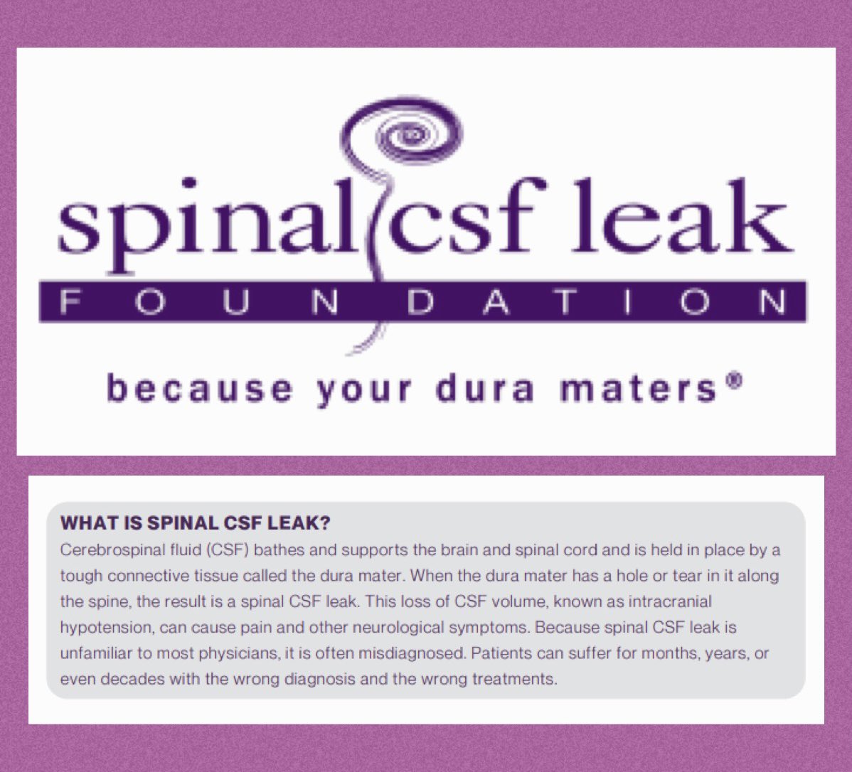 KLJulle's tweet image. April 20 is the 1 Year Anniversary of my CSF Leak Surgery.  After 2+ years of headaches, I have now been headache free for the last year.  Thank you Dr. Wouter Schievink &amp;amp; his team for giving me my life back.  
#csfleak #spinalCSFleak @spinalCSFleak @WouterSchievink